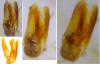 Dorcatoma sp.